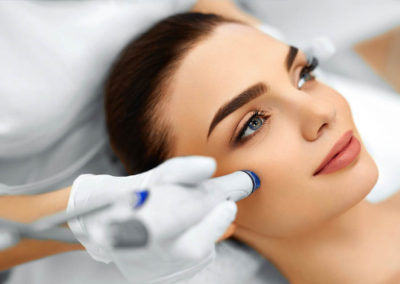 Microneedling procedure