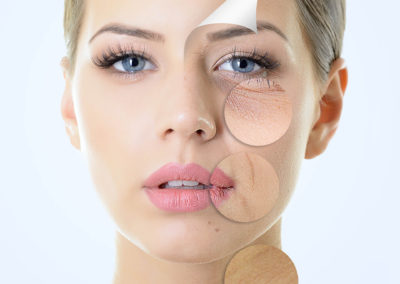 The Miracle of Microneedling